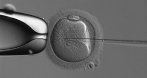 O papel da injeção intracitoplasmática de espermatozoides (ICSI) na infertilidade de fator não masculino na idade materna avançada